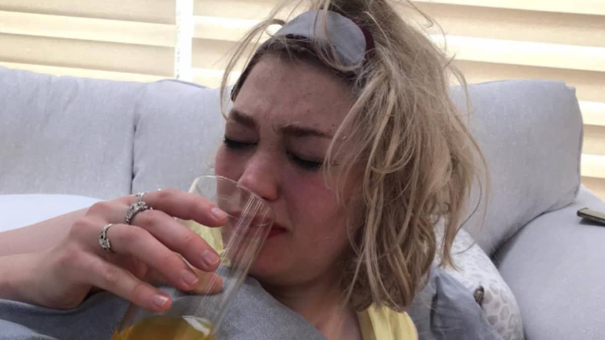 Women Are Sharing Pictures Of Their Worst Hangovers