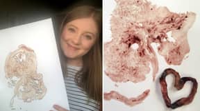 Midwife Earns An Extra £8k A Year By Making Placenta Products