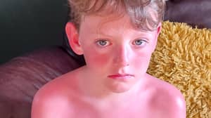 Little Boy 'Burnt To A Crisp' Despite Wearing Poundland Sun Cream
