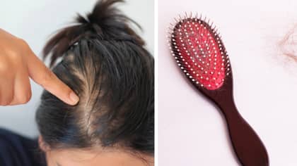 There's A Totally Legit Reason Why You're Losing More Hair Than Usual