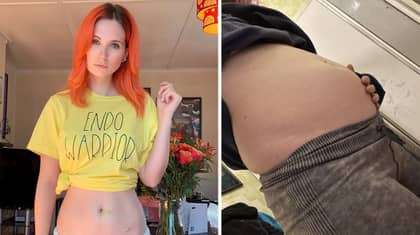 Woman Claims Heavy Periods From Endometriosis 'Ruined' Her Sex Life And Bloat Made Her Look Pregnant