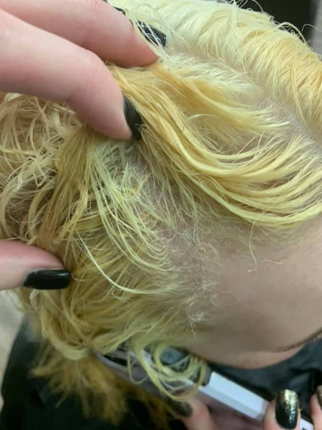 Woman Issues Urgent Warning After Her Hair 'Melted Off' During At-Home  Bleaching Disaster - Tyla