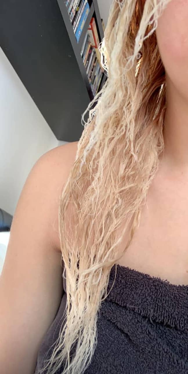 Chelsea's hair started coming out in the shower (Credit: Chelsea-Jayde Hayward)