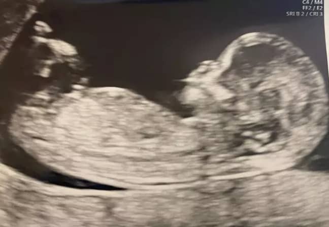 The couple also shared a scan picture (Credit: Dani Dyer/Instagram)