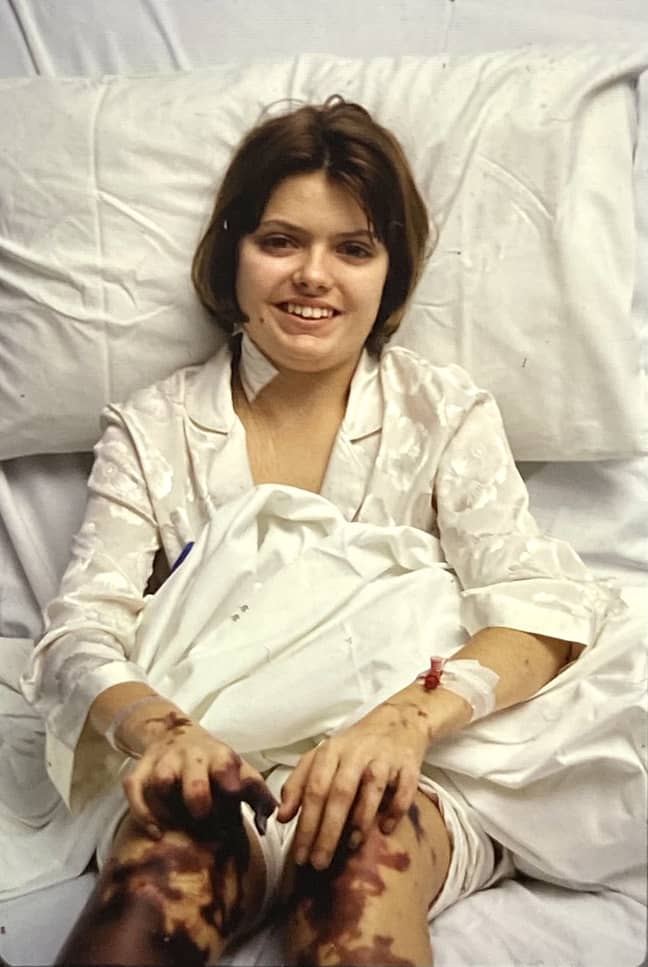 Another image shows Sophia in hospital before the amputation (Credit: Kennedy) 
