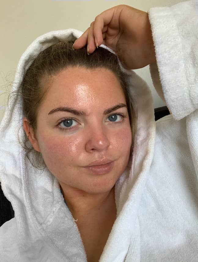 Vanessa is learning to love her skin (Credit: Triangle News) 