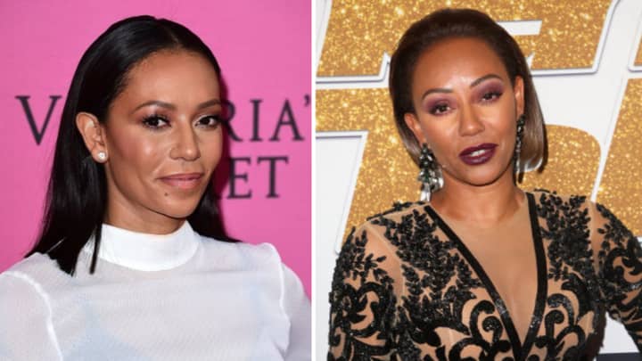 Mel B Flaunts Dramatic Results Of '£4,000 Non Surgical Facelift'