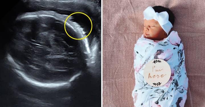 Mum-To-Be Left In Shock After Scan Reveals Her Baby's Luscious Locks