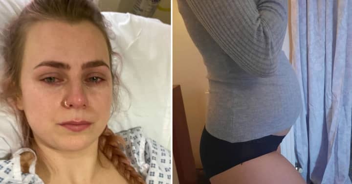 Woman's Agonising Abdominal Pain Turned Out To Be Her Organs Fusing Together