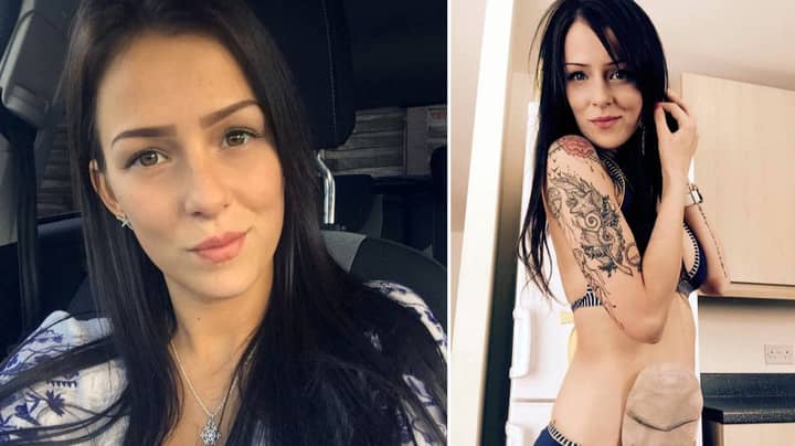 Woman Wants To Become First National Beauty Pageant Winner With Colostomy Bag