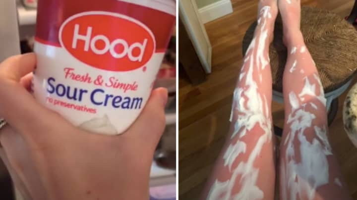 People Are Using Sour Cream To Treat Sunburn - And No
