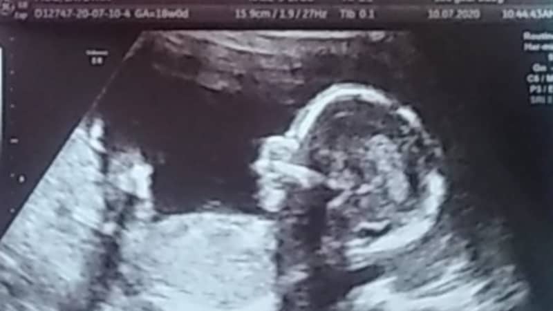 Mum Shocked As Cheeky Baby Swears In Hilarious Ultrasound